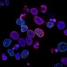 Can EMS Help Cancer Patients? Groundbreaking 2025 Study Shows Positive Results in Just 2 Weeks