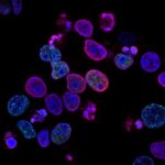 Can EMS Help Cancer Patients? Groundbreaking 2025 Study Shows Positive Results in Just 2 Weeks