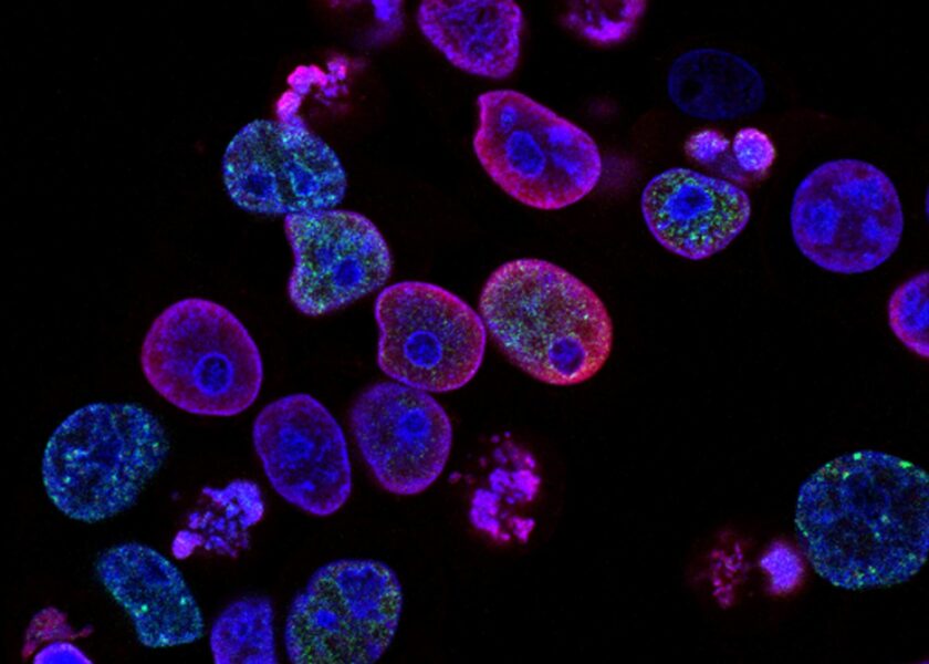 cancer-ems-worout-study